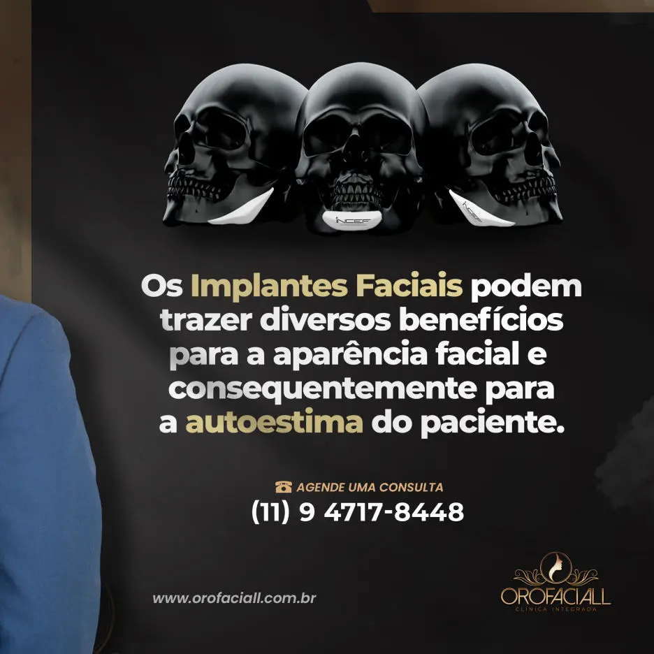 Superlativo Comunicação